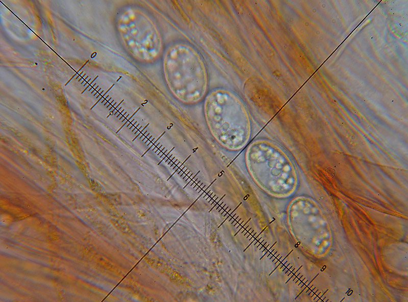 Mixomiceti con Scutellinia